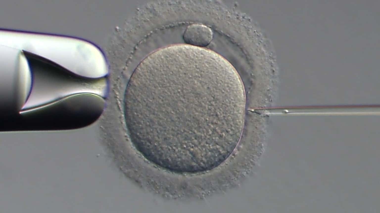 ICSI Fecundación in vitro